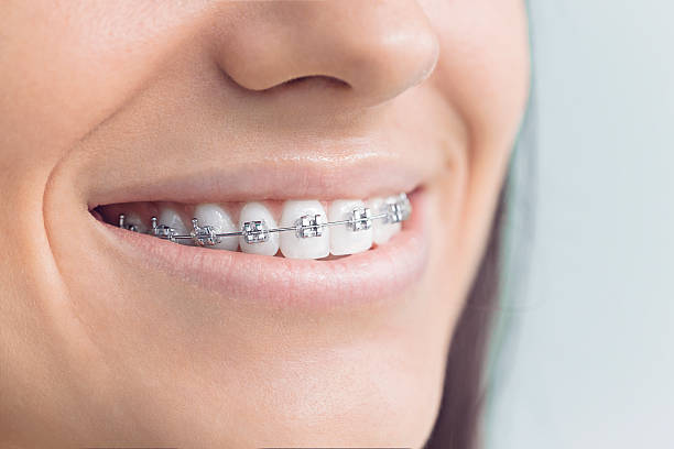 Best Traditional Braces  in Texarkana, TX